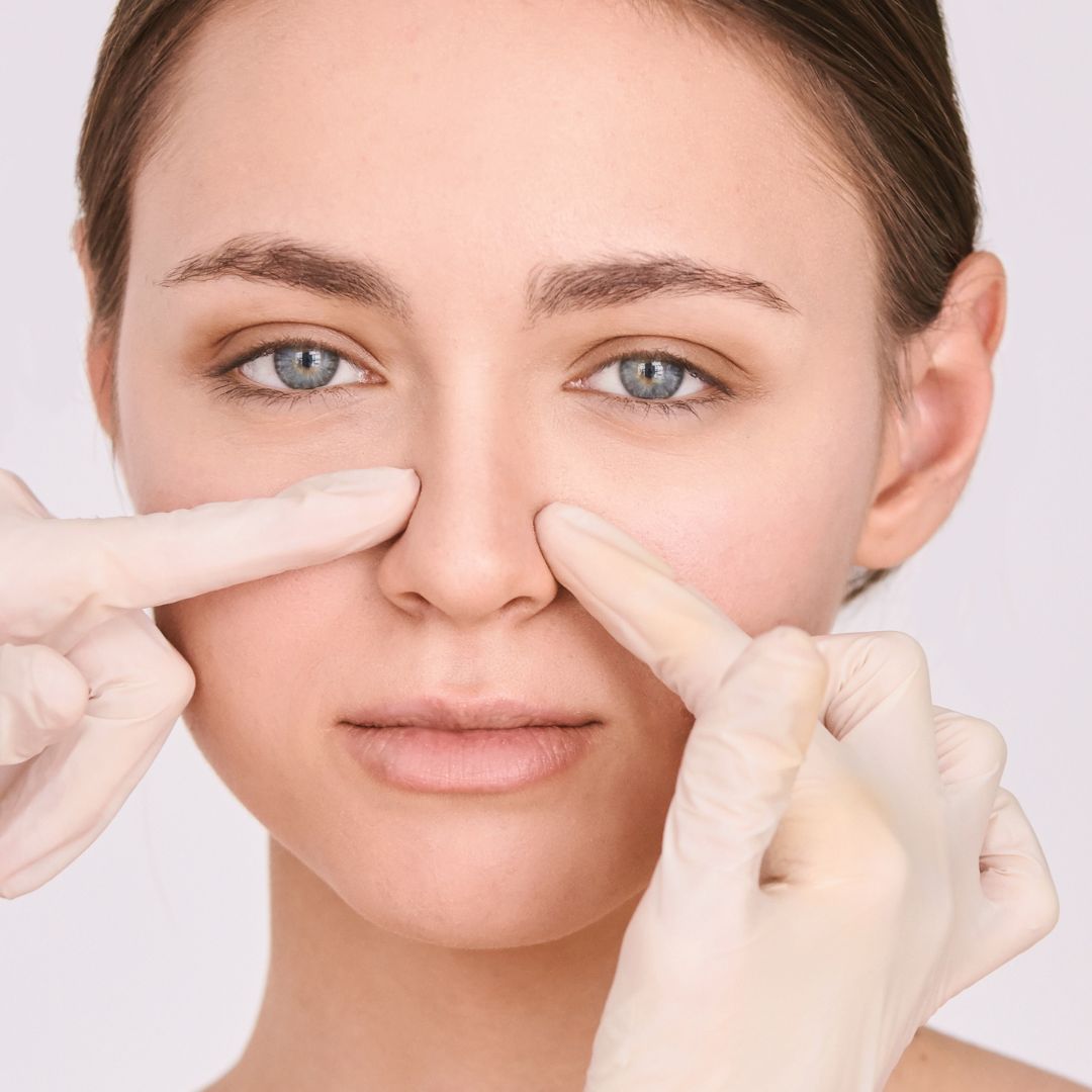 Non-surgical Nose Reshaping